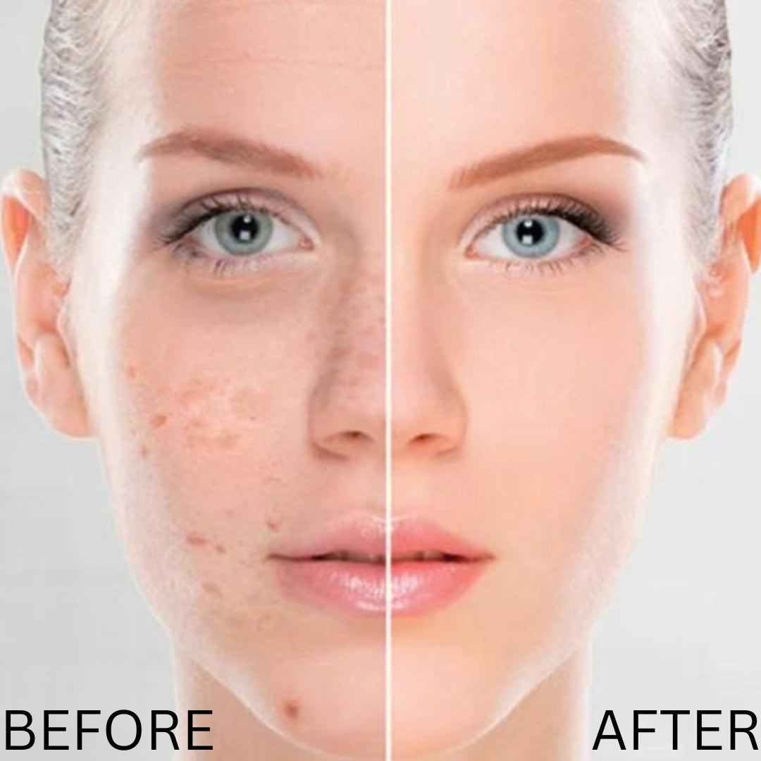 Mandelic Acid Serum
