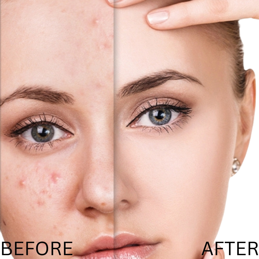 Vitamin C Serum