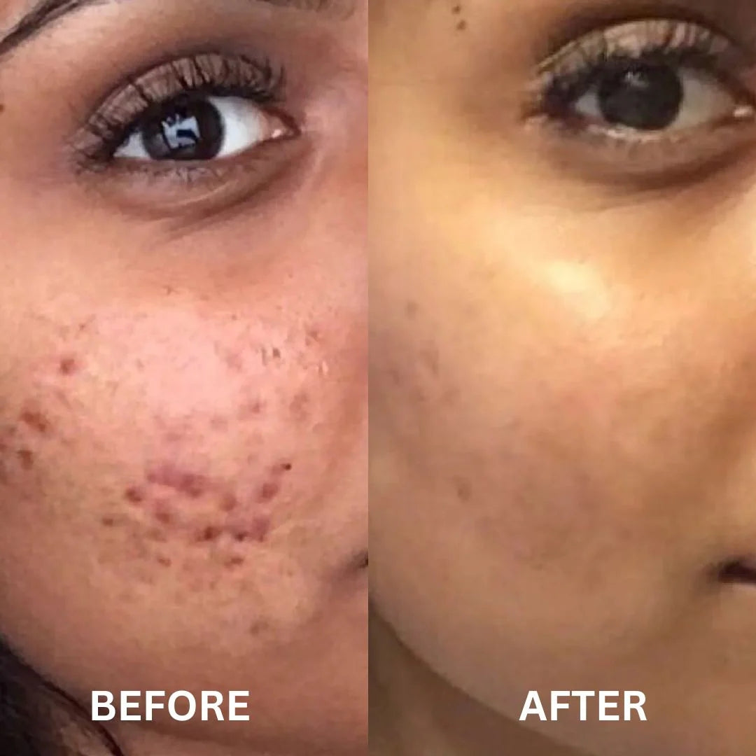 Mandelic Acid Serum